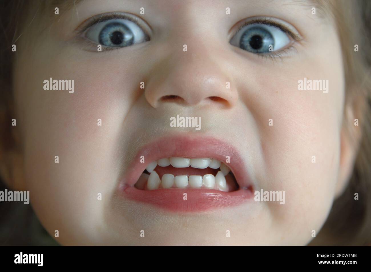 El primer plano extremo de la cara de la niña muestra su expresión aterrorizada. Sus ojos están abultados y sus dientes están apretados. Foto de stock