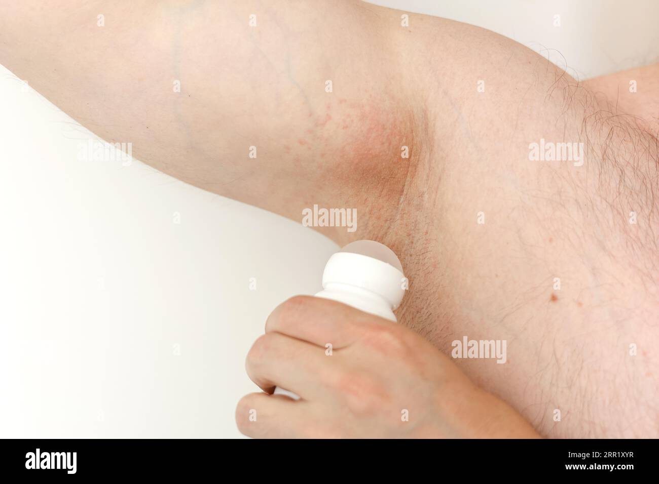 Alergia en las axilas. Foto recortada de irritación, inflamación en la piel  sensible después de usar una maquinilla de afeitar, recortador, desodorante  tóxico o antitranspirante. Brazo Fotografía de stock - Alamy
