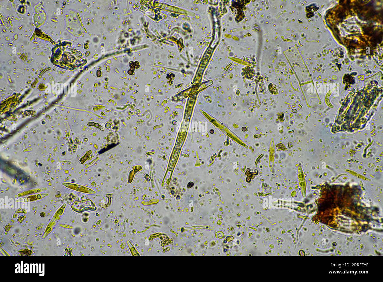 Hifas fúngicas y hongos bajo el microscopio en el suelo y compost, en