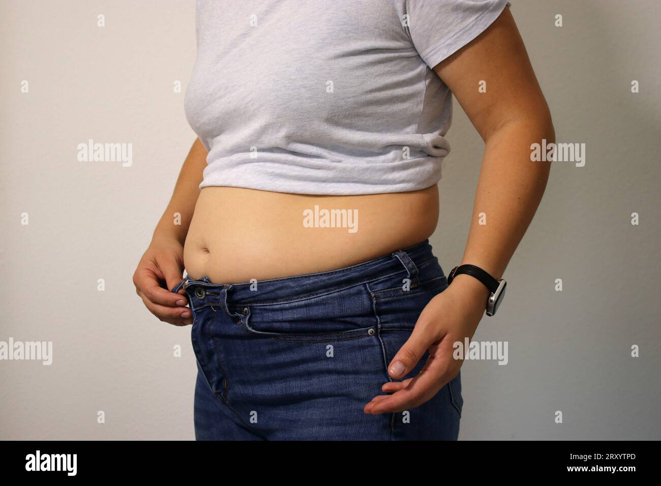 Mujer joven muestra su vientre caído después de perder peso y