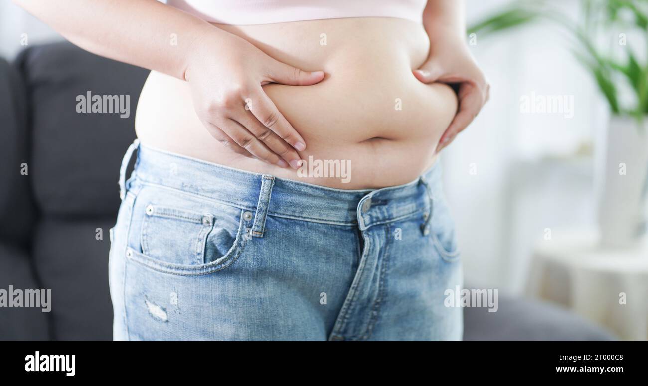 Mujer obesa con grasa molesta por su vientre. Mujer con sobrepeso tocando su vientre gordo y quiere perder peso. Mujer gorda con tigh Foto de stock