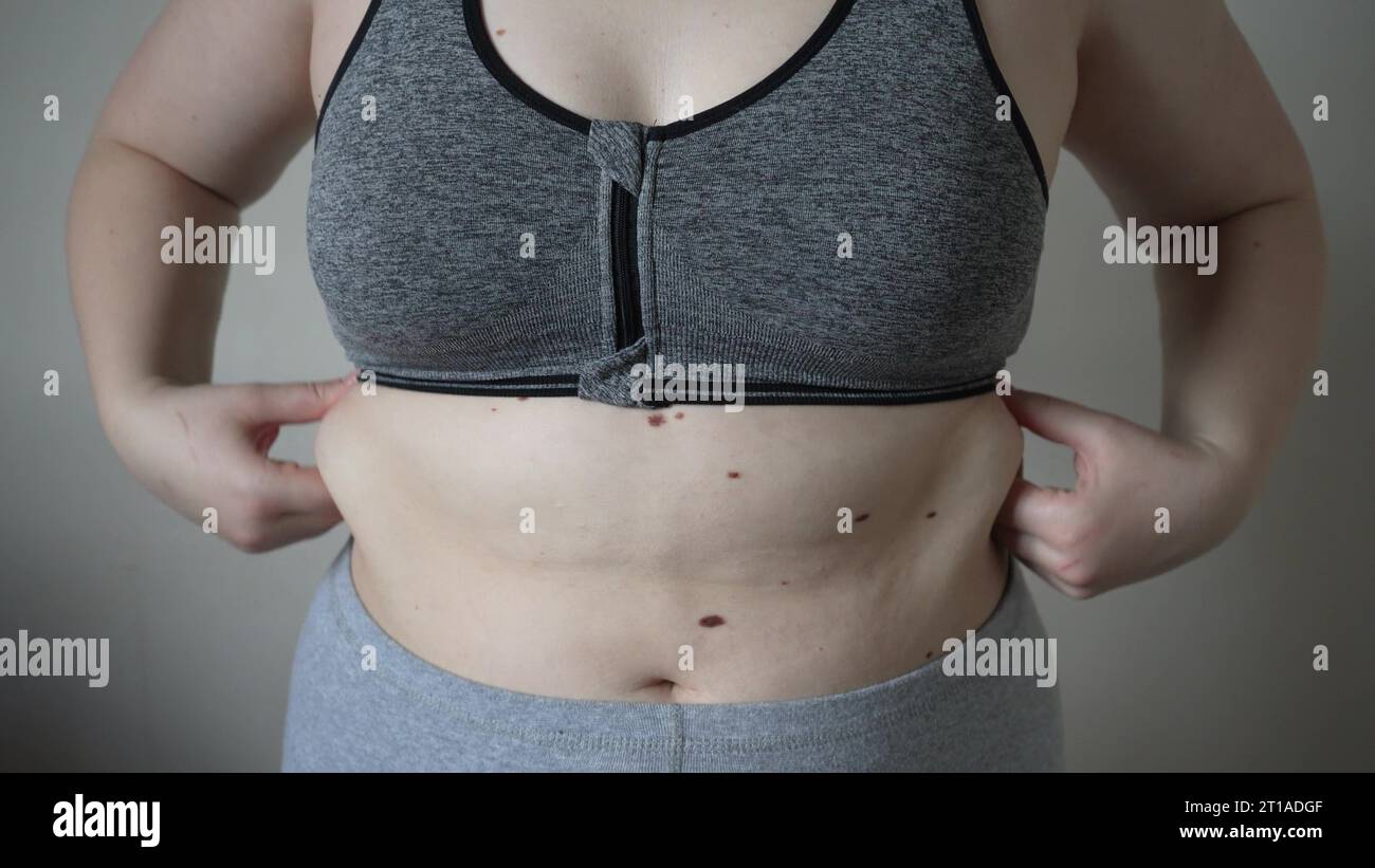 Primer plano de pliegues de grasa en el gran vientre de una mujer con sobrepeso. Concepto de sobrepeso, obesidad femenina, dieta y problemas de sobrepeso Foto de stock