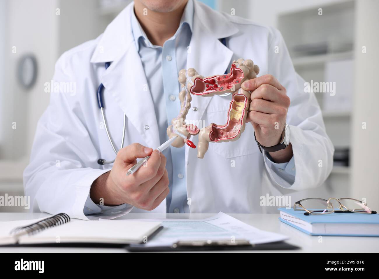 Gastroenterólogo que muestra el modelo anatómico del intestino grueso en la mesa en clínica, primer plano Foto de stock