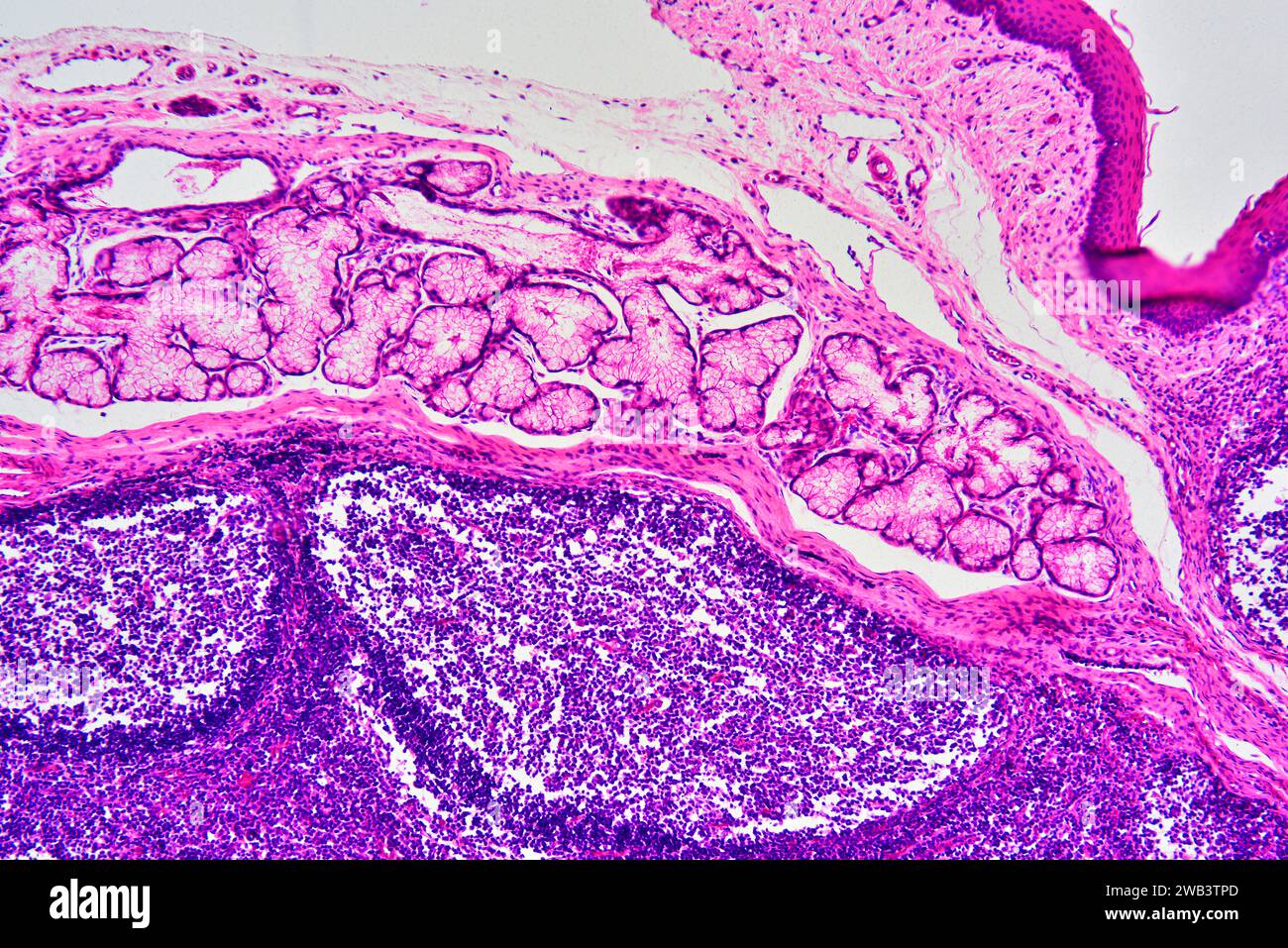 Glándula salival humana que muestra acini, parénquima y conductos secretores. X75 a 10 cm de ancho. Foto de stock