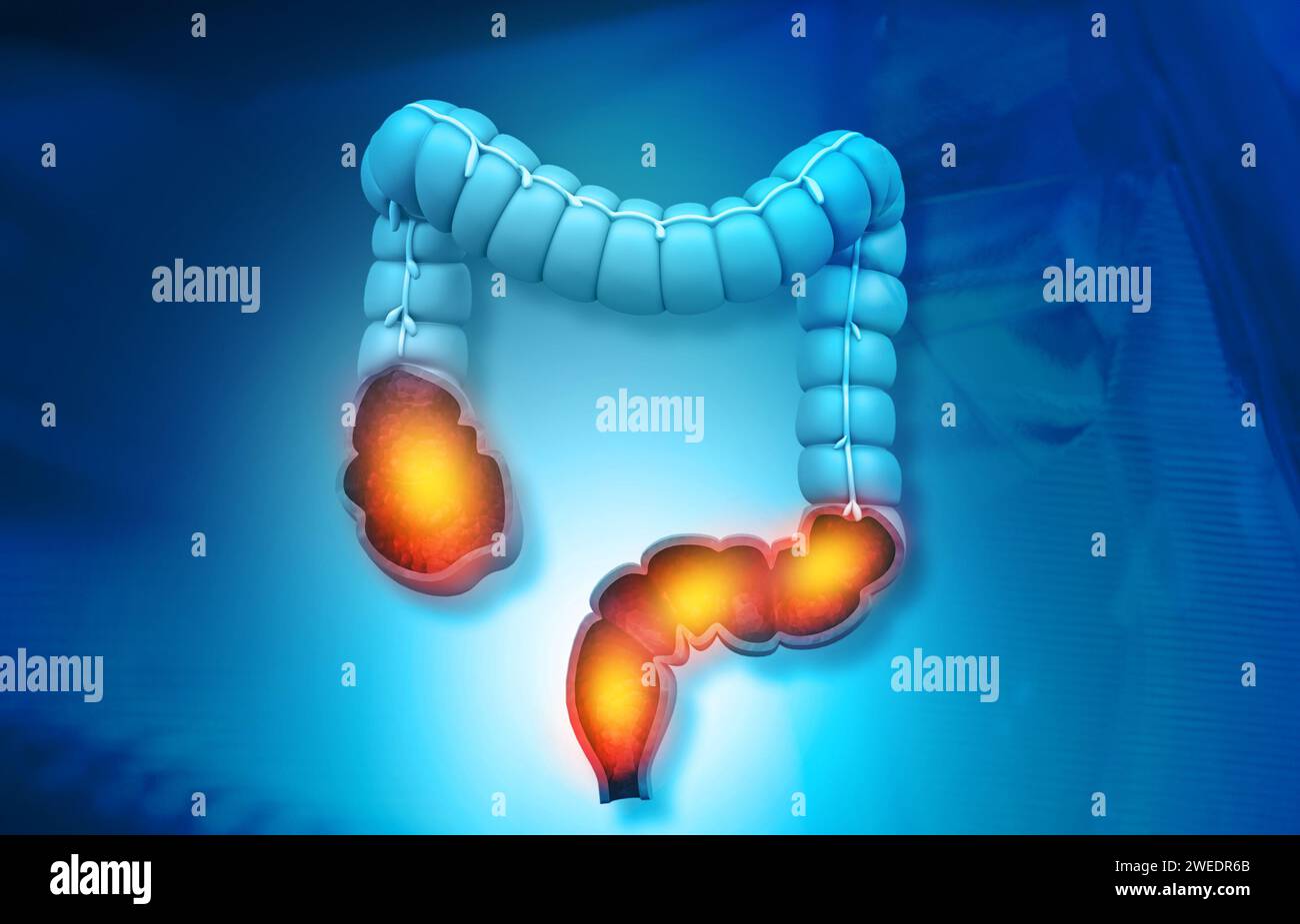 Modelo de anatomía del intestino grueso sobre fondo médico. ilustración 3d. Foto de stock