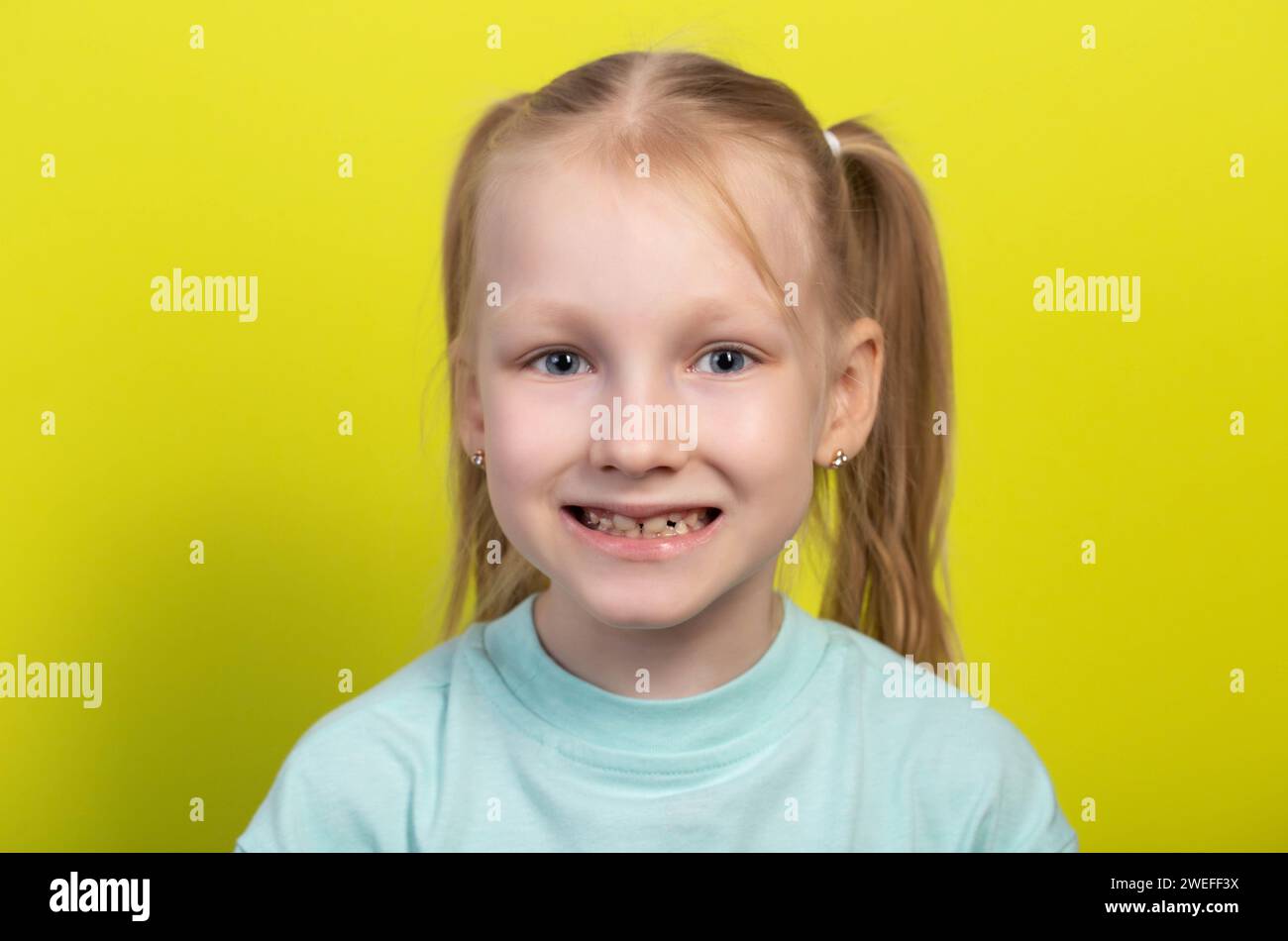 Retrato de una niña sonriente de siete años con molares crecientes y dientes de bebé caídos. Defectos de los dientes torcidos en la cavidad oral. Abolladura de los niños Foto de stock