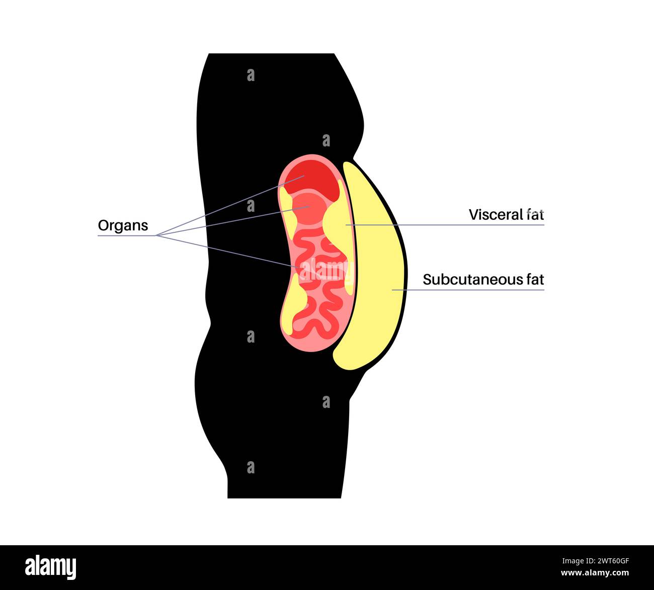 Diagrama de grasa visceral, ilustración. La grasa del vientre rodea los órganos internos en la cavidad abdominal. Foto de stock