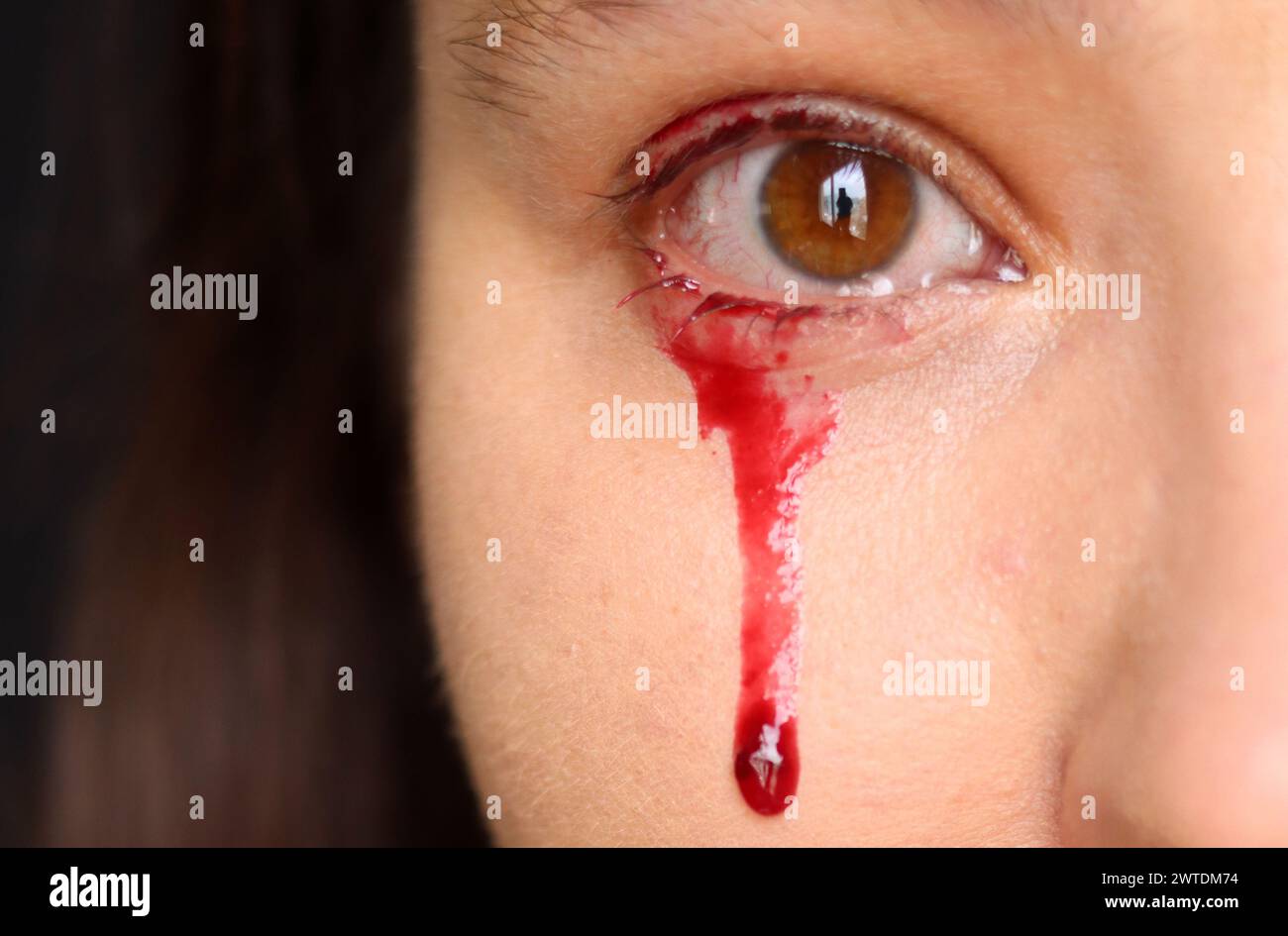 Cerrar la foto de un ojo femenino con la sangre derramando de ella. Foto de stock
