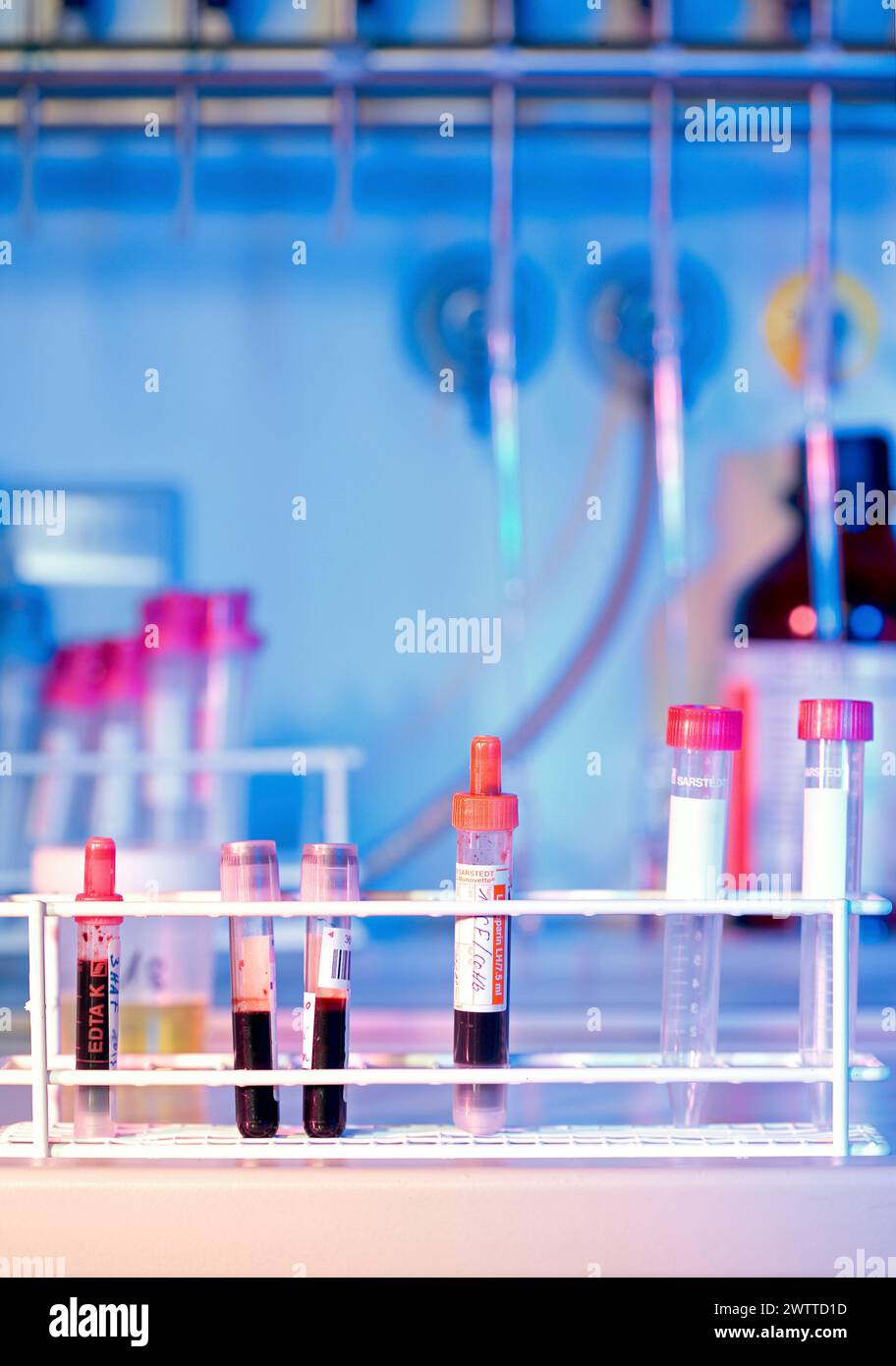 Tubos de ensayo que contienen muestras de sangre en un banco de laboratorio Foto de stock