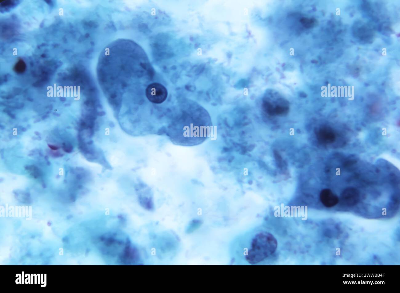 Parásito Ameba Entamoeba Coli Fotografías E Imágenes De Alta Resolución Alamy 9817