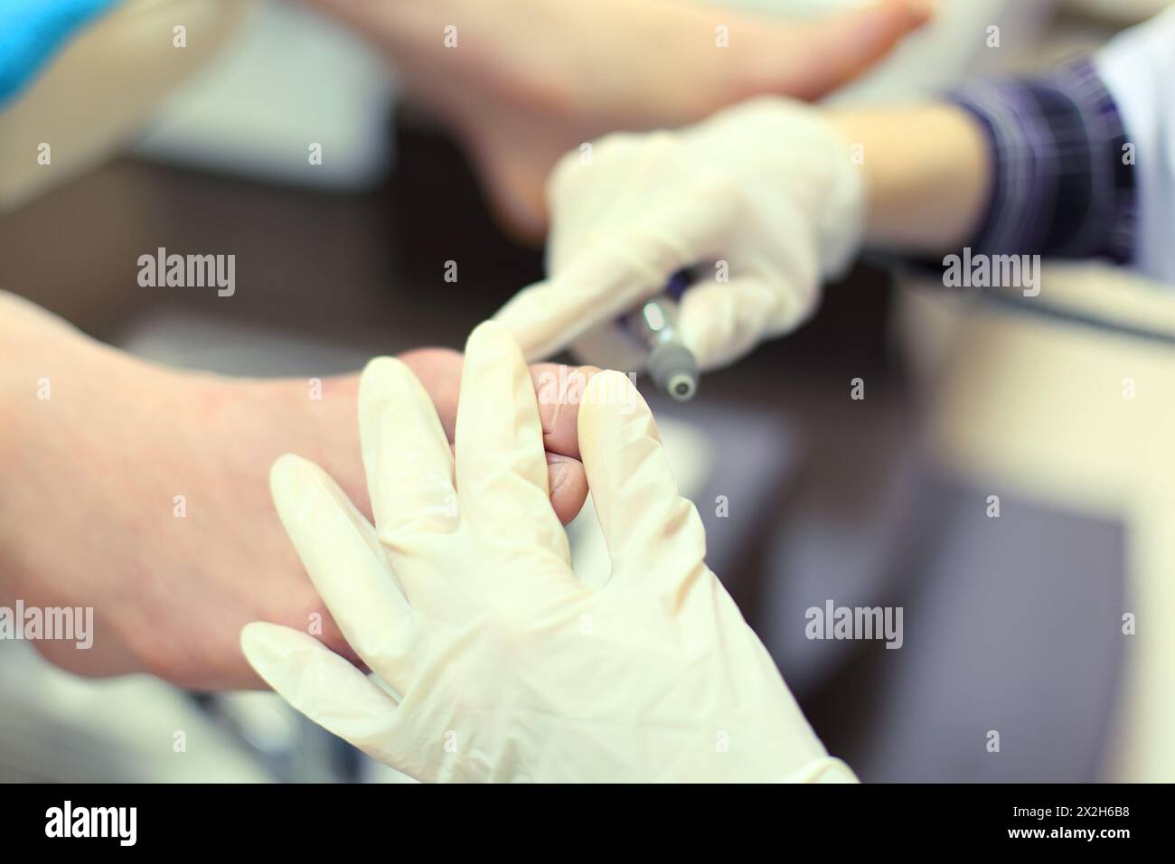 Manos de mujer que llevan guantes de goma practicando quiropody cuidando  los pies masculinos Fotografía de stock - Alamy