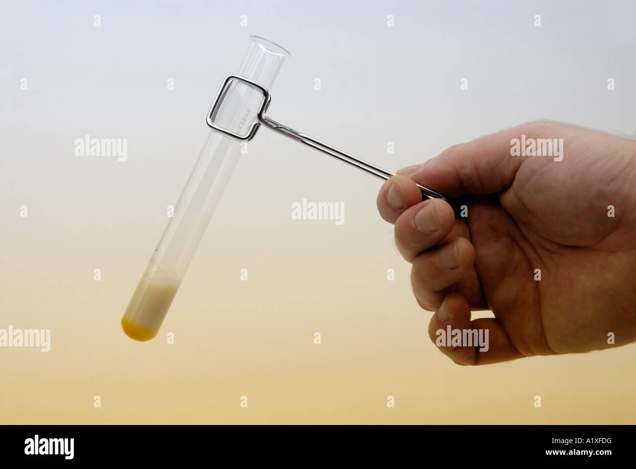 Reazione di benedicts fotografías e imágenes de alta resolución Alamy