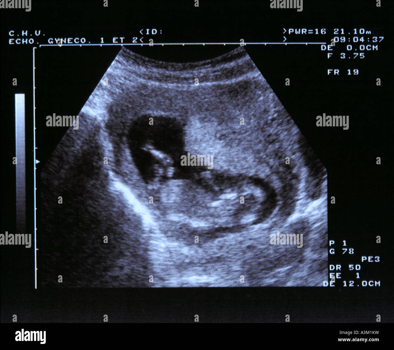 My Image 2