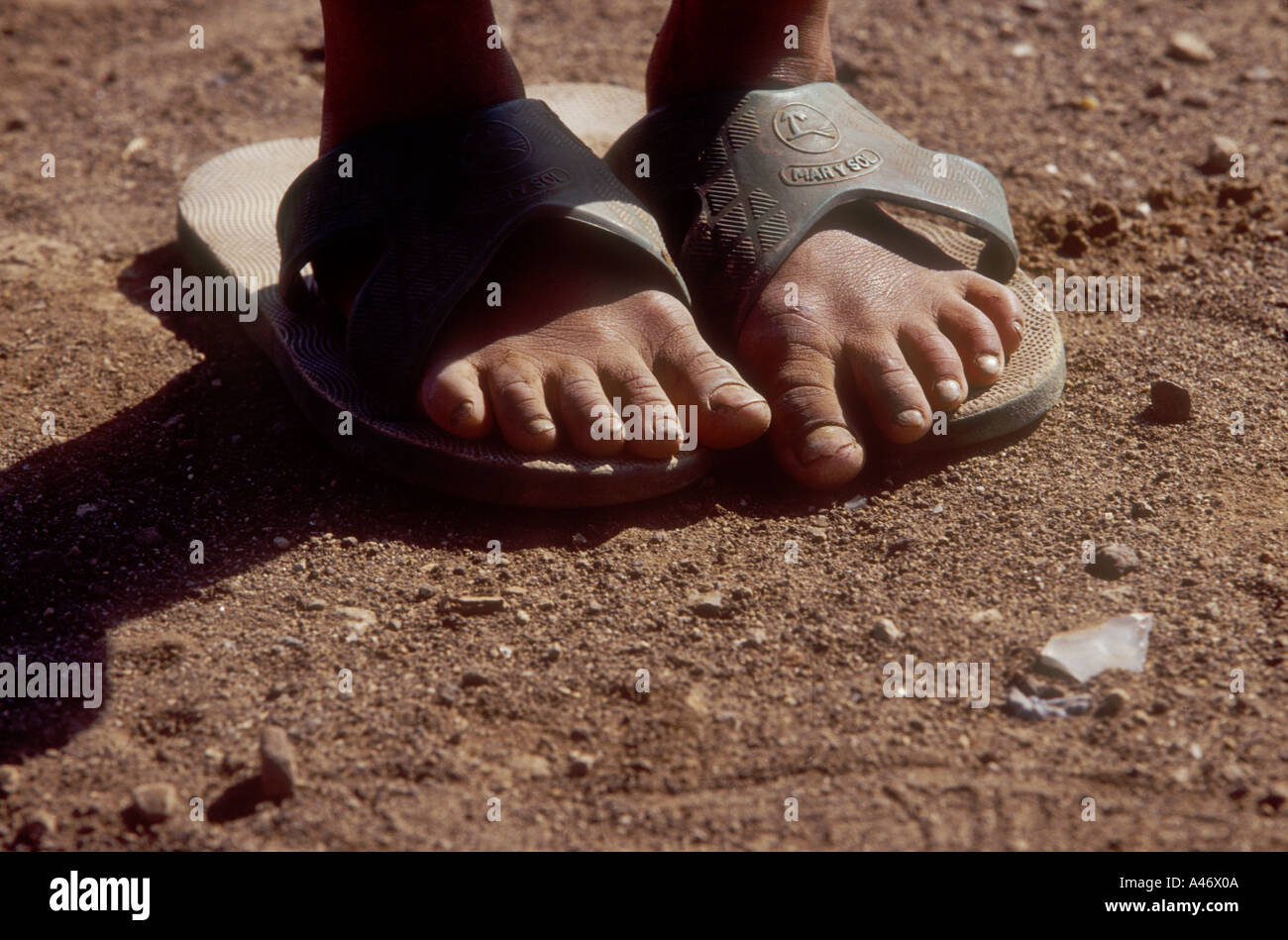 Los pies de un niño en sandalias que son demasiado grandes, Villa Nueva  barriada, Honduras Fotografía de stock - Alamy