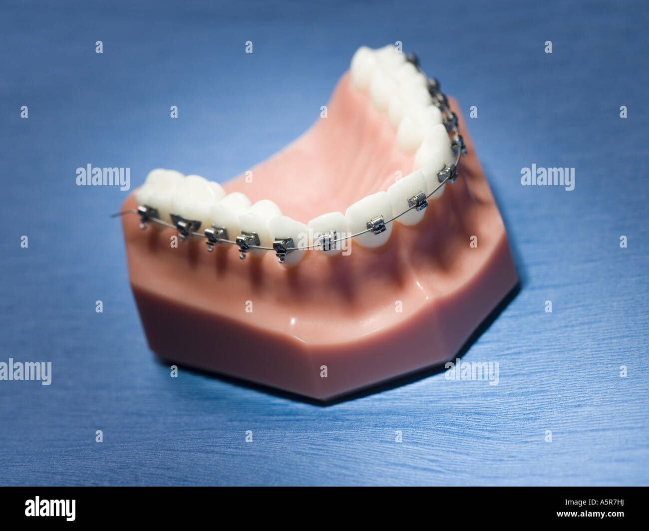 Los dientes postizos con llaves Fotografía de stock - Alamy