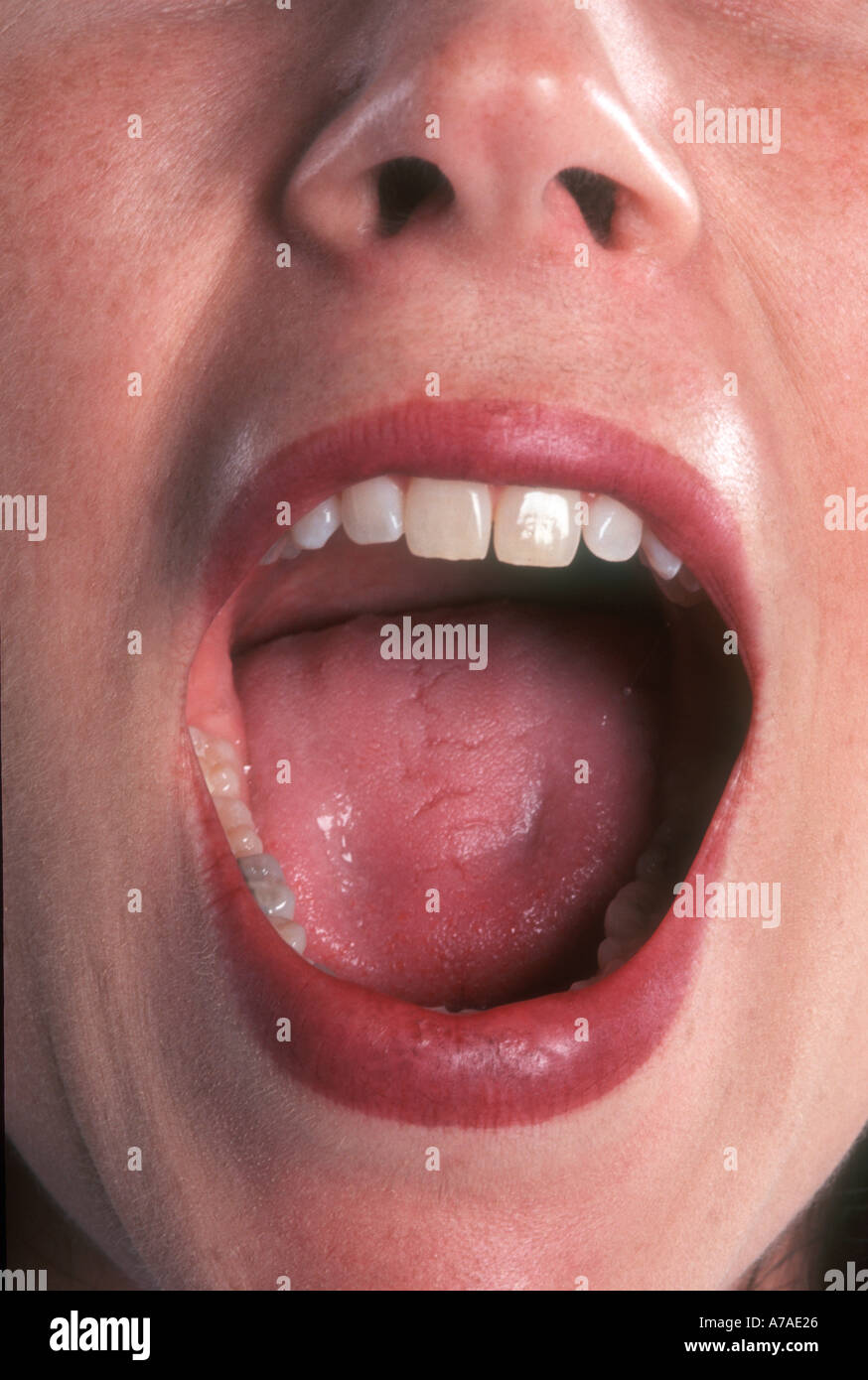 Mujer con la boca abierta gritando Foto de stock
