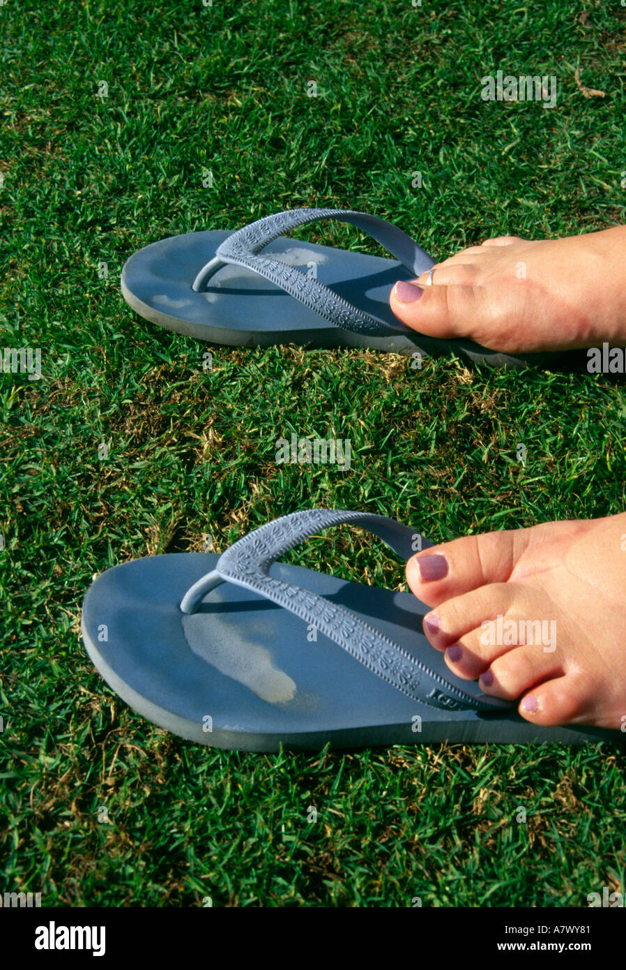 Sandalias de pies hinchados fotografías e imágenes de alta resolución -  Alamy