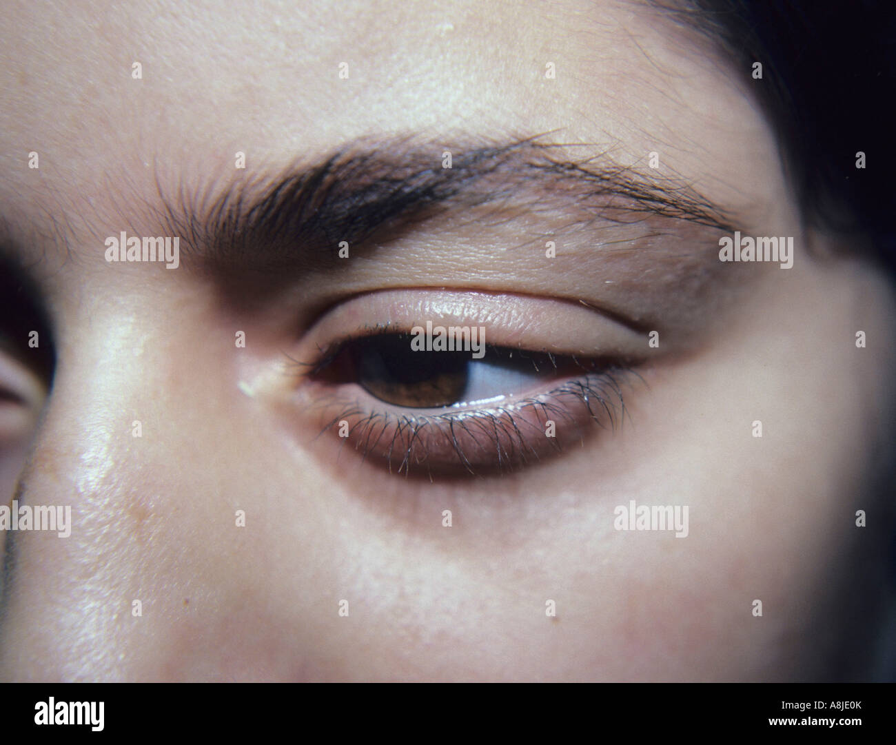Alopecia de cejas fotografías e imágenes de alta resolución - Alamy