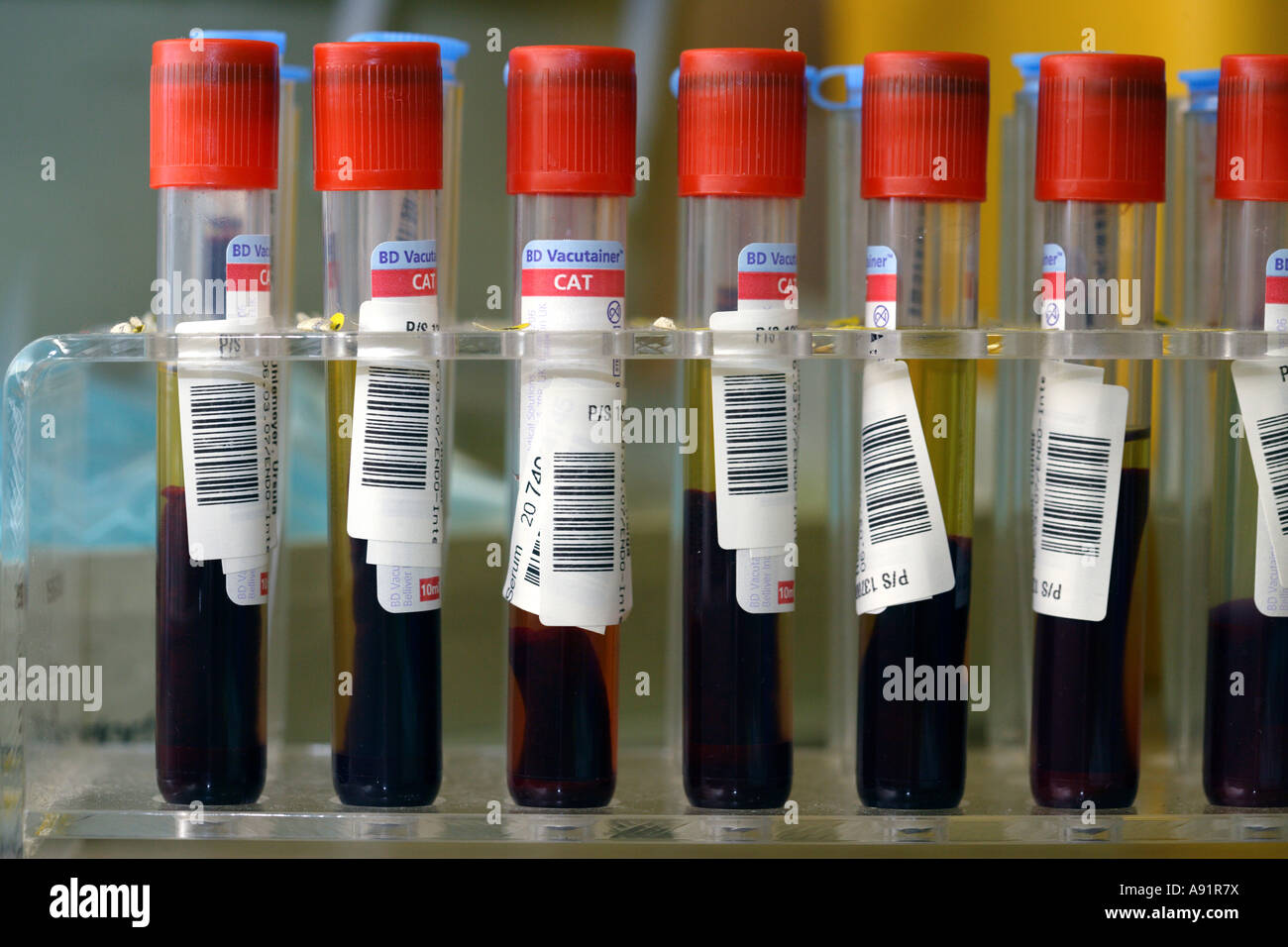 Exámenes de sangre Foto de stock