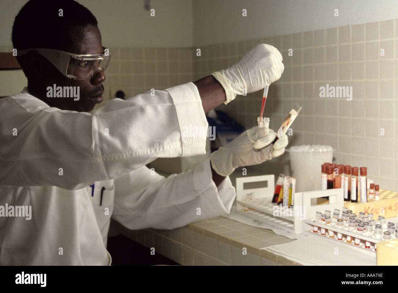Abidjan, Costa de Marfil, África. Técnico de Laboratorio de Preparación de muestras de sangre para realizar pruebas en el Laboratorio de Investigación sobre el SIDA Foto de stock