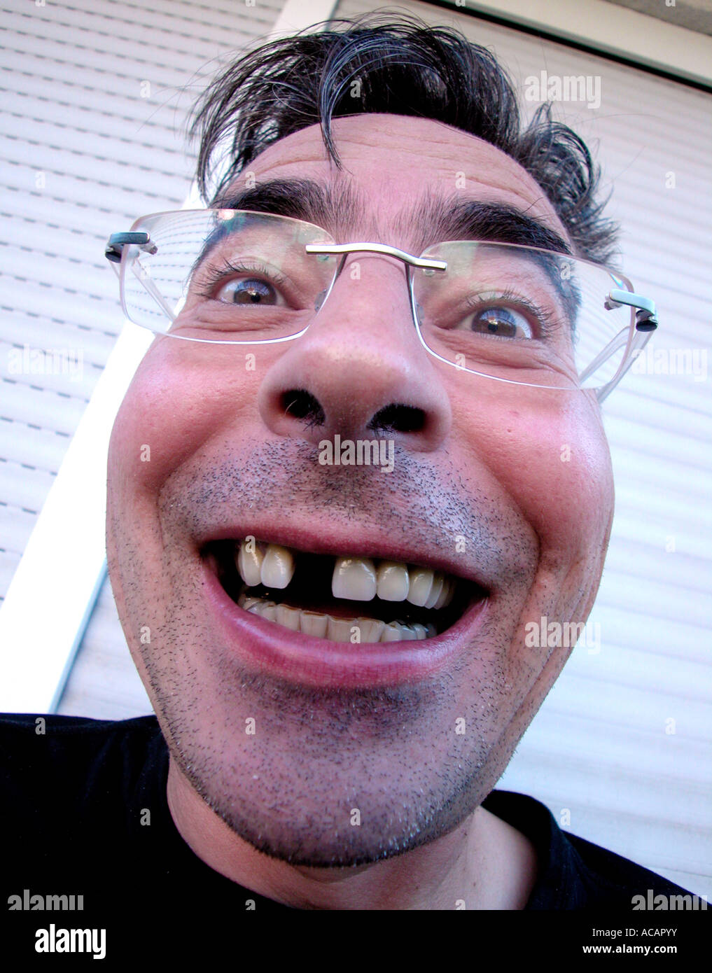 Hombre con un diente hueco Foto de stock