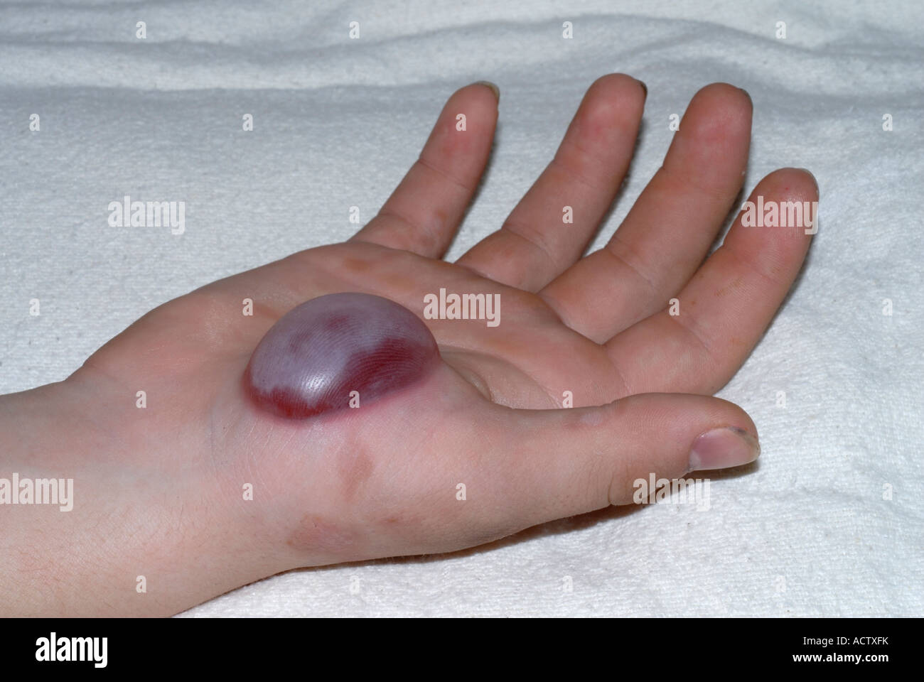 Ampolla en mano fotografías e imágenes de alta resolución - Alamy