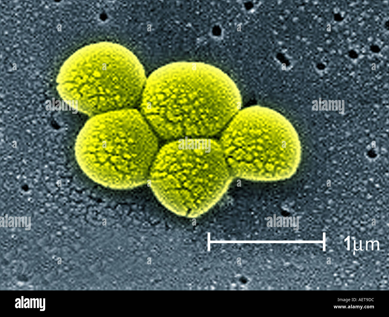 Imagen por microscopio electrónico de barrido de la bacteria estafilococo  MRSA Fotografía de stock - Alamy