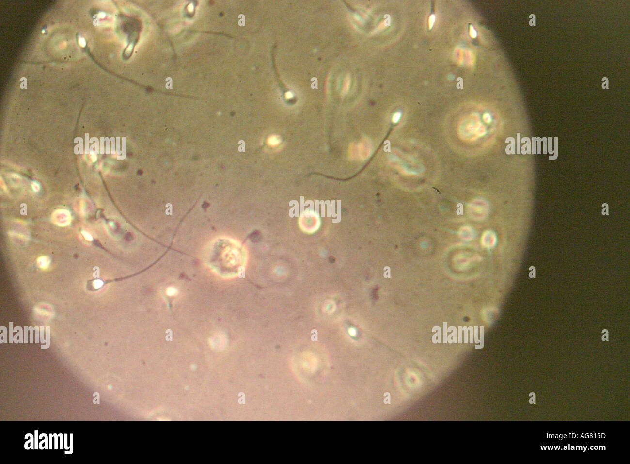 Espermatozoides microscopio fotografías e imágenes de alta resolución -  Alamy