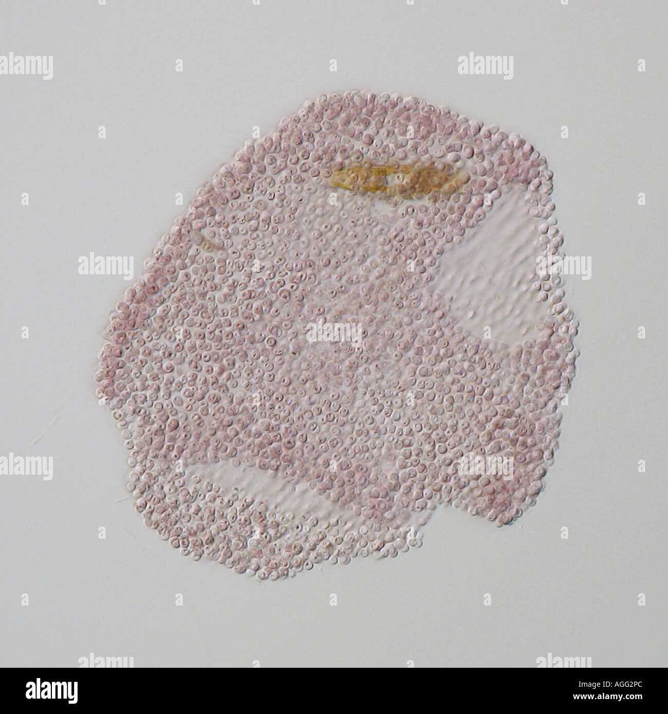 Microcystis flos-aquae (Microcystis flos-aquae), en una brillante-a través de la luz Foto de stock