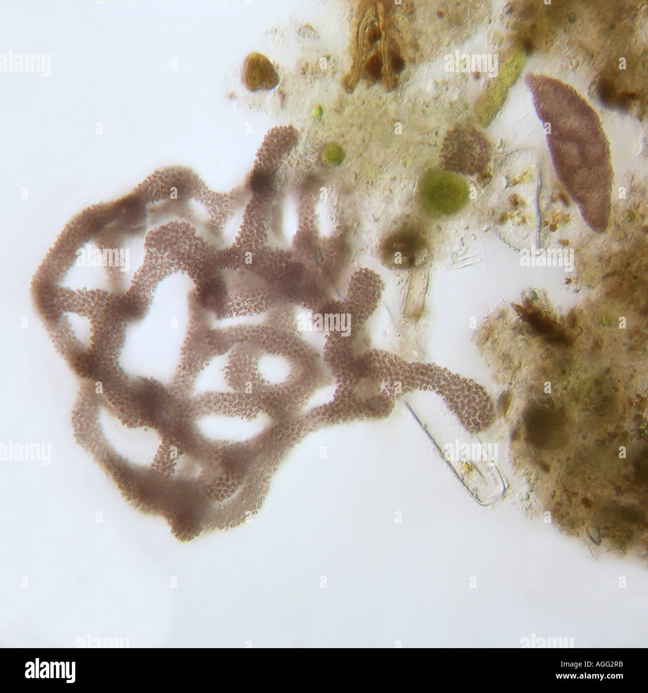 Microcystis aeruginosa (Microcystis aeruginosa), en una brillante-a través de la luz Foto de stock
