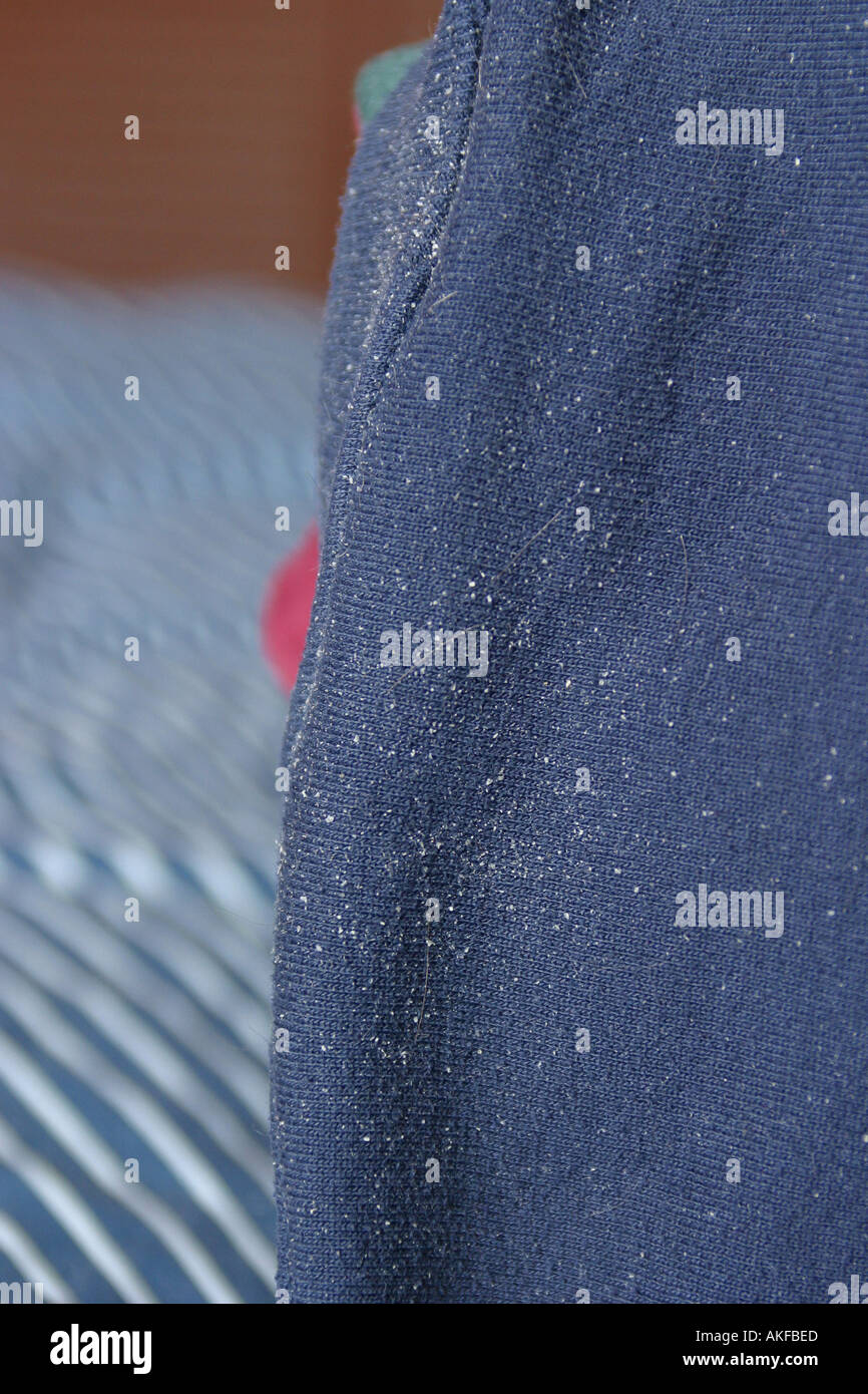 La caspa en mans ropa alrededor del cuello de un área pullover Fotografía  de stock - Alamy