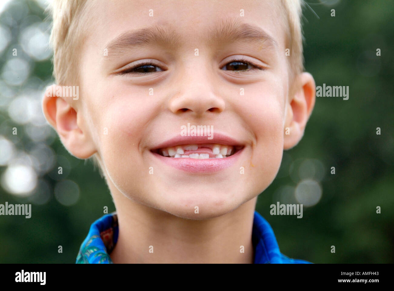 Nino De 8 Anos Con Dos Delanteros Faltan Los Dientes Del Bebe Y El Crecimiento De Los Dientes Permanentes Fotografia De Stock Alamy