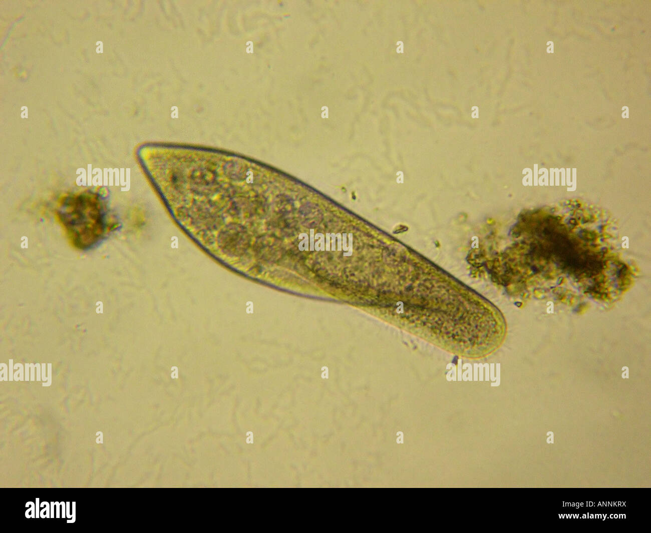 Paramecio micromicronucleatum imagen del espécimen vivo Foto de stock