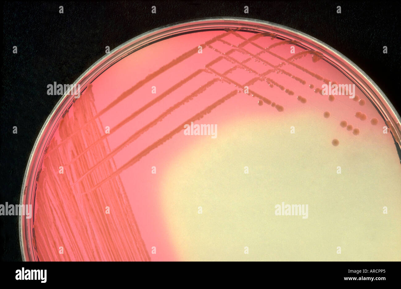 Una fotografía de una placa petri cultura de la bacteria Escherichia coli. Foto de stock