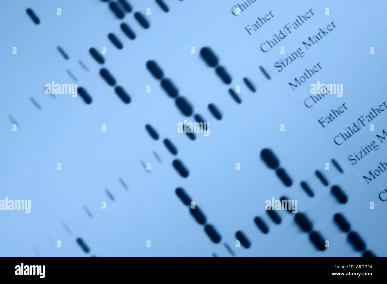 Autoradiograph de 'DNA huellas digitales' de investigaciones de determinación de paternidad Foto de stock