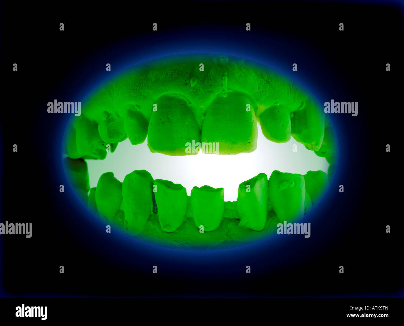 Modell für Zahnersatz prótesis dentales Foto de stock