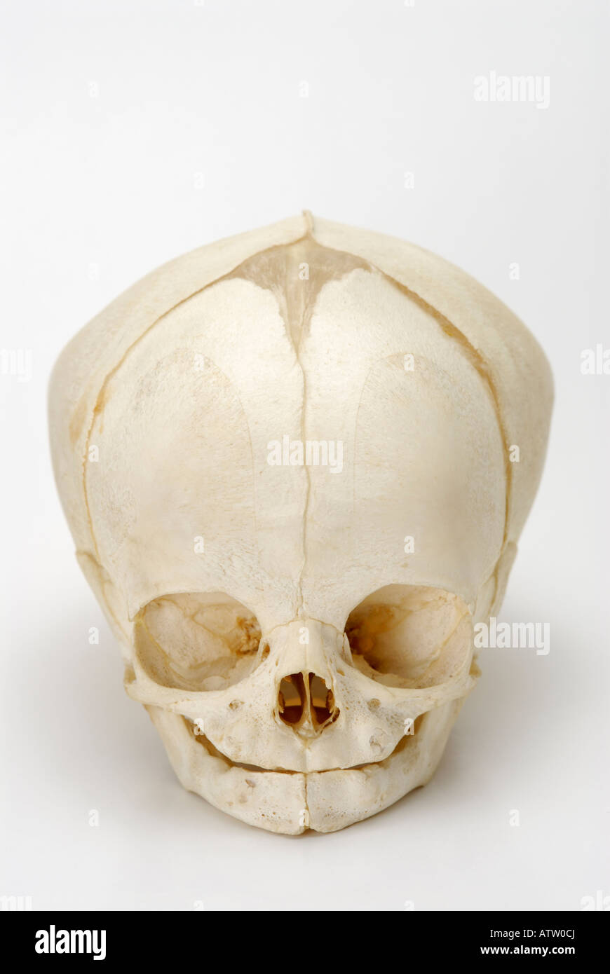 Cráneo de un feto humano el feto a término Foto de stock