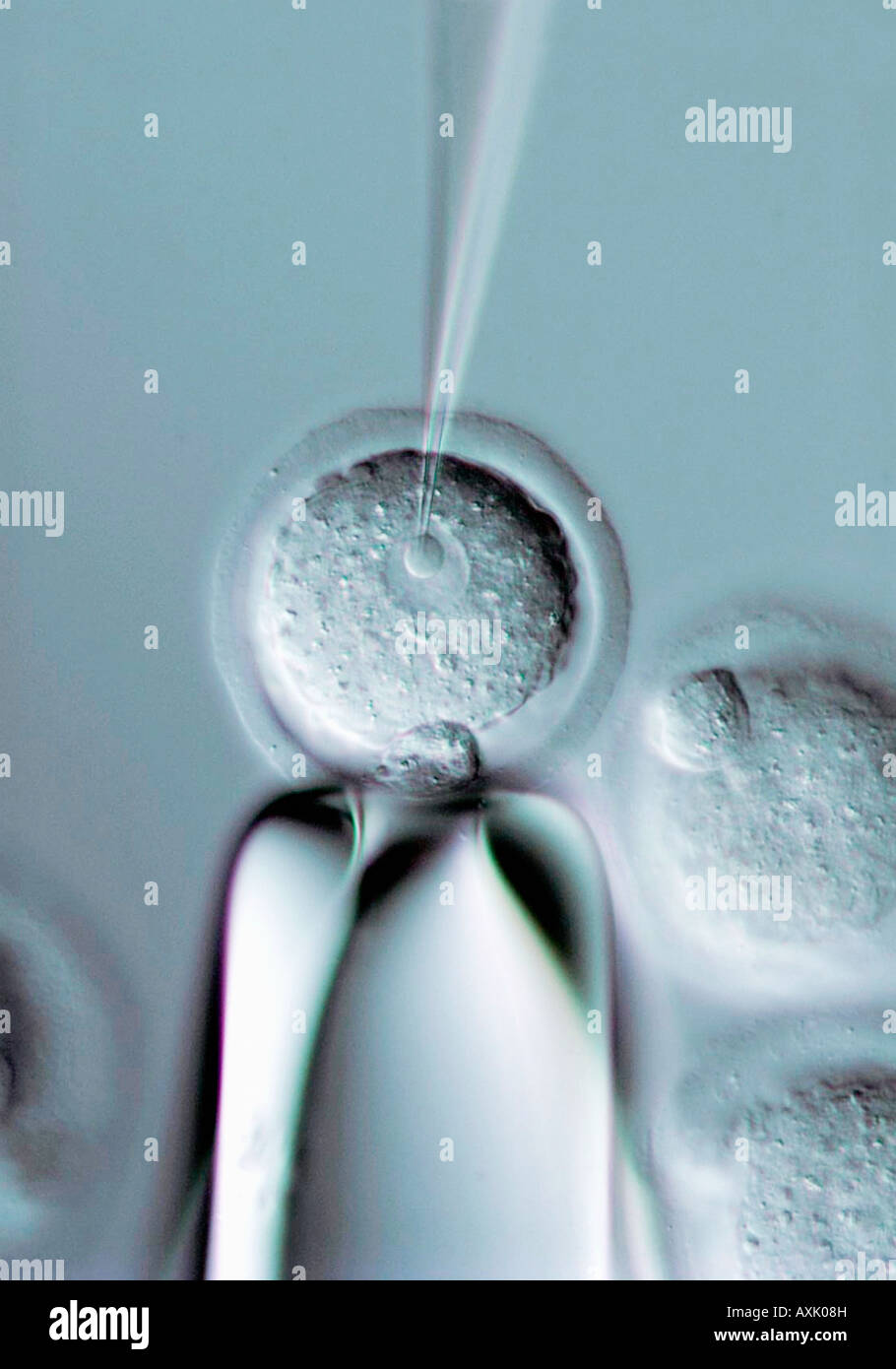 Microinyección de clonación de células madre embrionales humanas las células ES en un óvulo fecundado Foto de stock