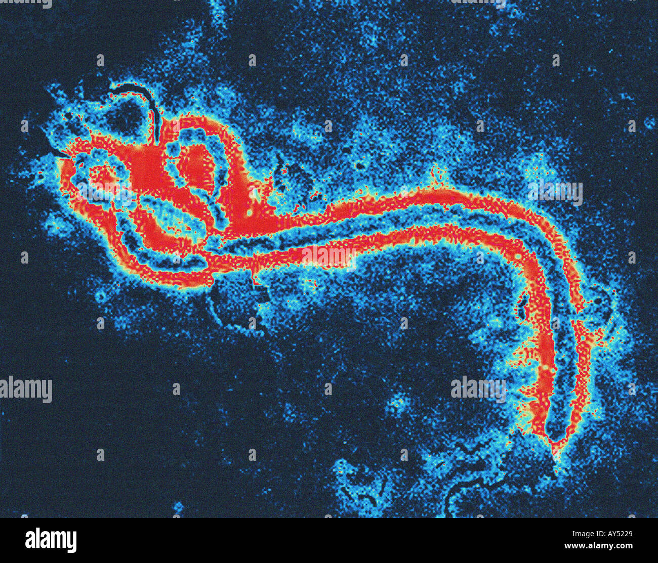 Microscopio Electrónico de Barrido SEM imagen del virus Ebola Fotografía de  stock - Alamy