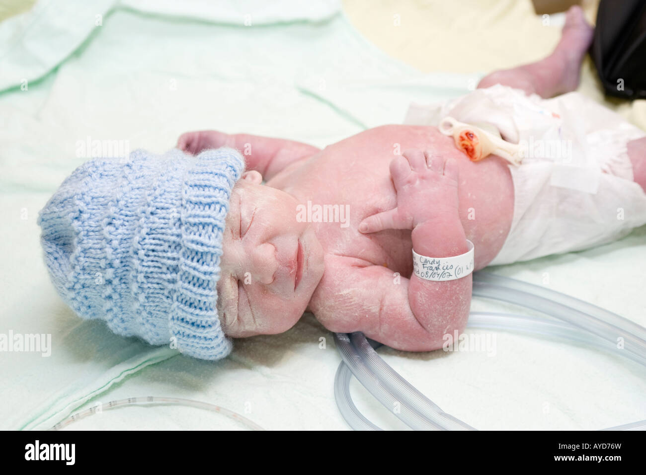 Un Bebe Prematuro 5 Semanas Segundos Despues De Nacer Fotografia De Stock Alamy Un Bebe Prematuro 5 Semanas Segundos Despues De Nacer Fotografia De Stock Alamy