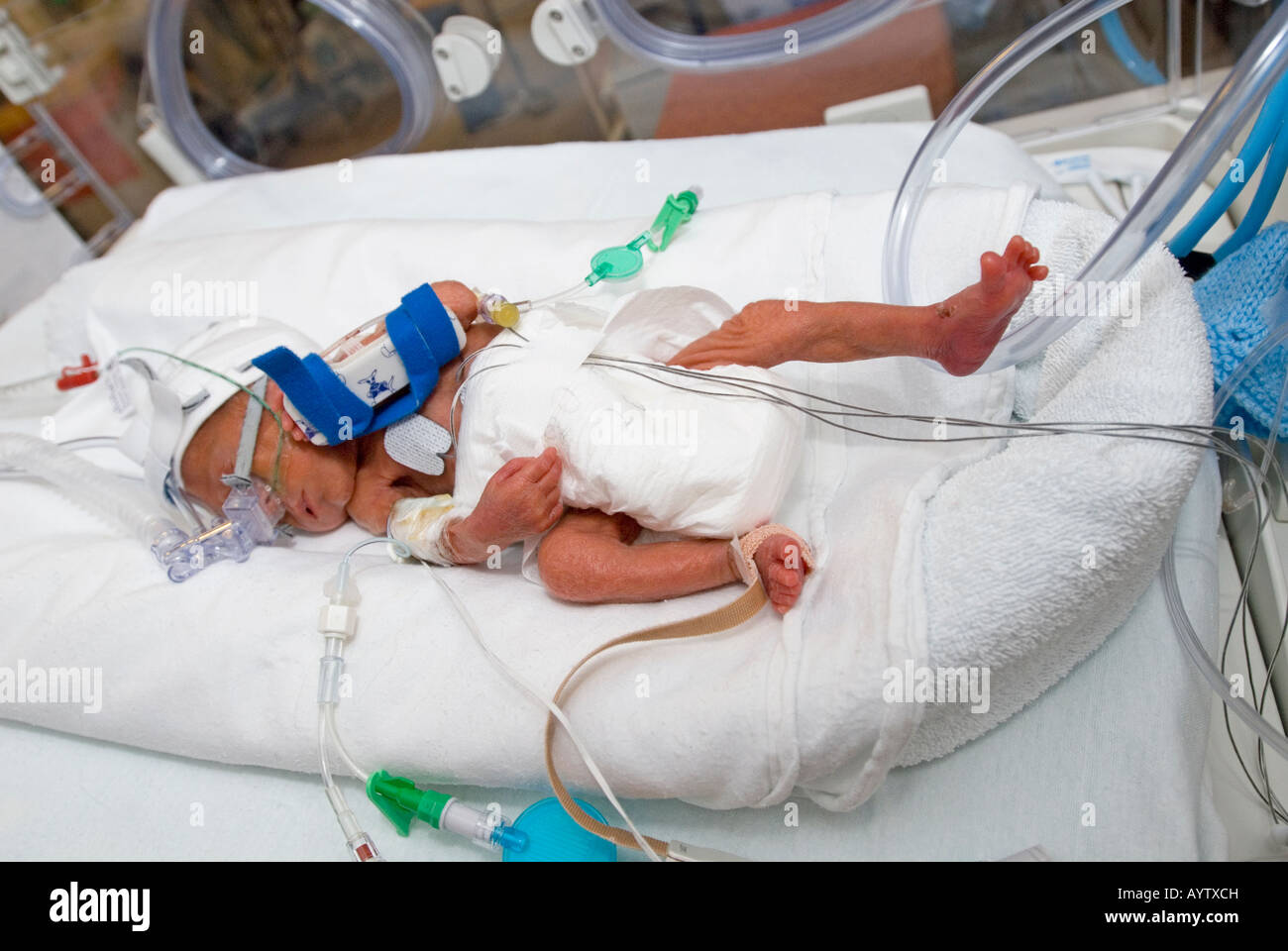 Bebé prematuro en incubadora Fotografía de stock - Alamy