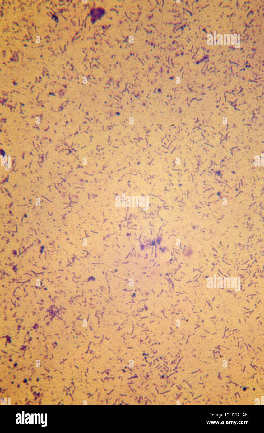 Light microscope bacteria yogurt fotografías e imágenes de alta