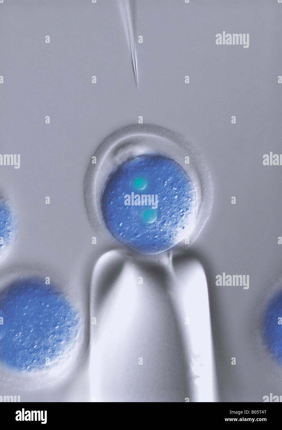 Microinyección de clonación de células madre embrionales humanas las células ES en un óvulo fecundado Foto de stock
