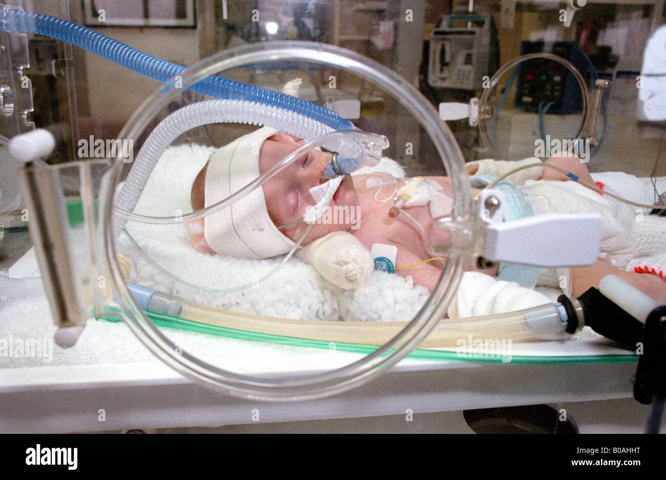 Bebé prematuro recién nacido en una incubadora de cuidados intensivos en un  hospital de NHS, Inglaterra, Reino Unido Fotografía de stock - Alamy