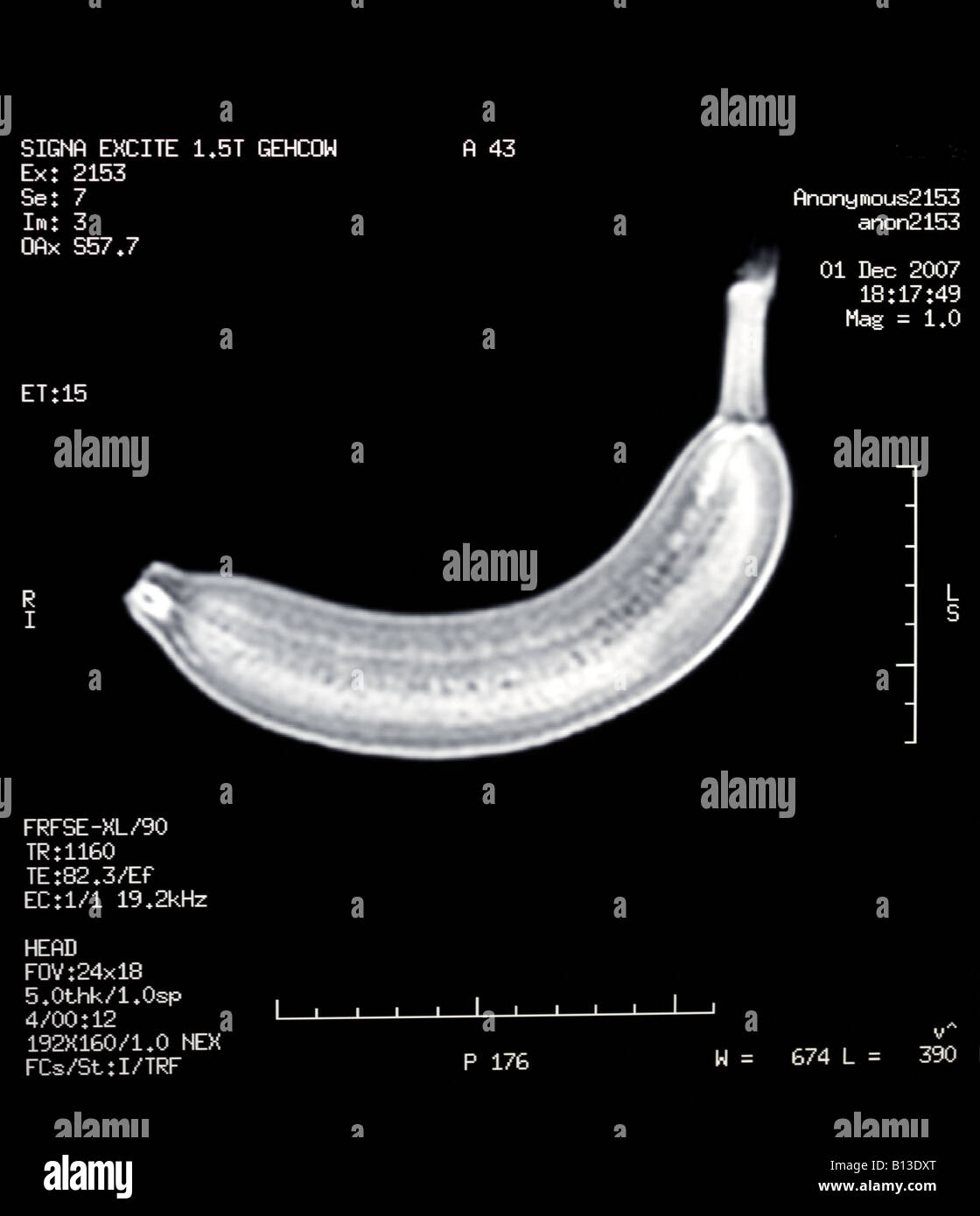 Resonancia magnética de un plátano Foto de stock