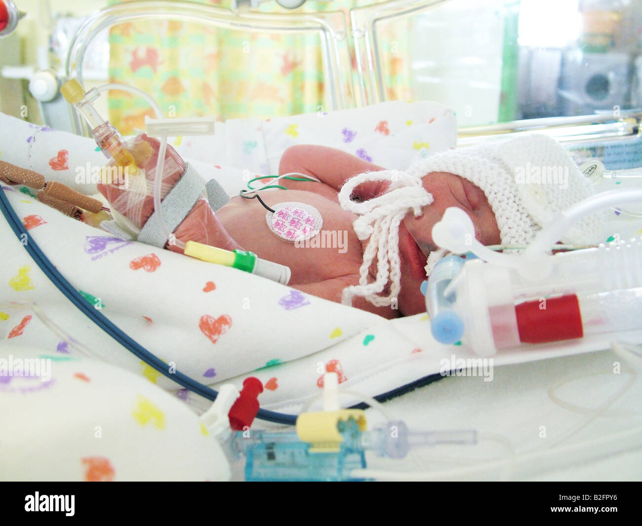 Bebé prematuro en incubadora Foto de stock