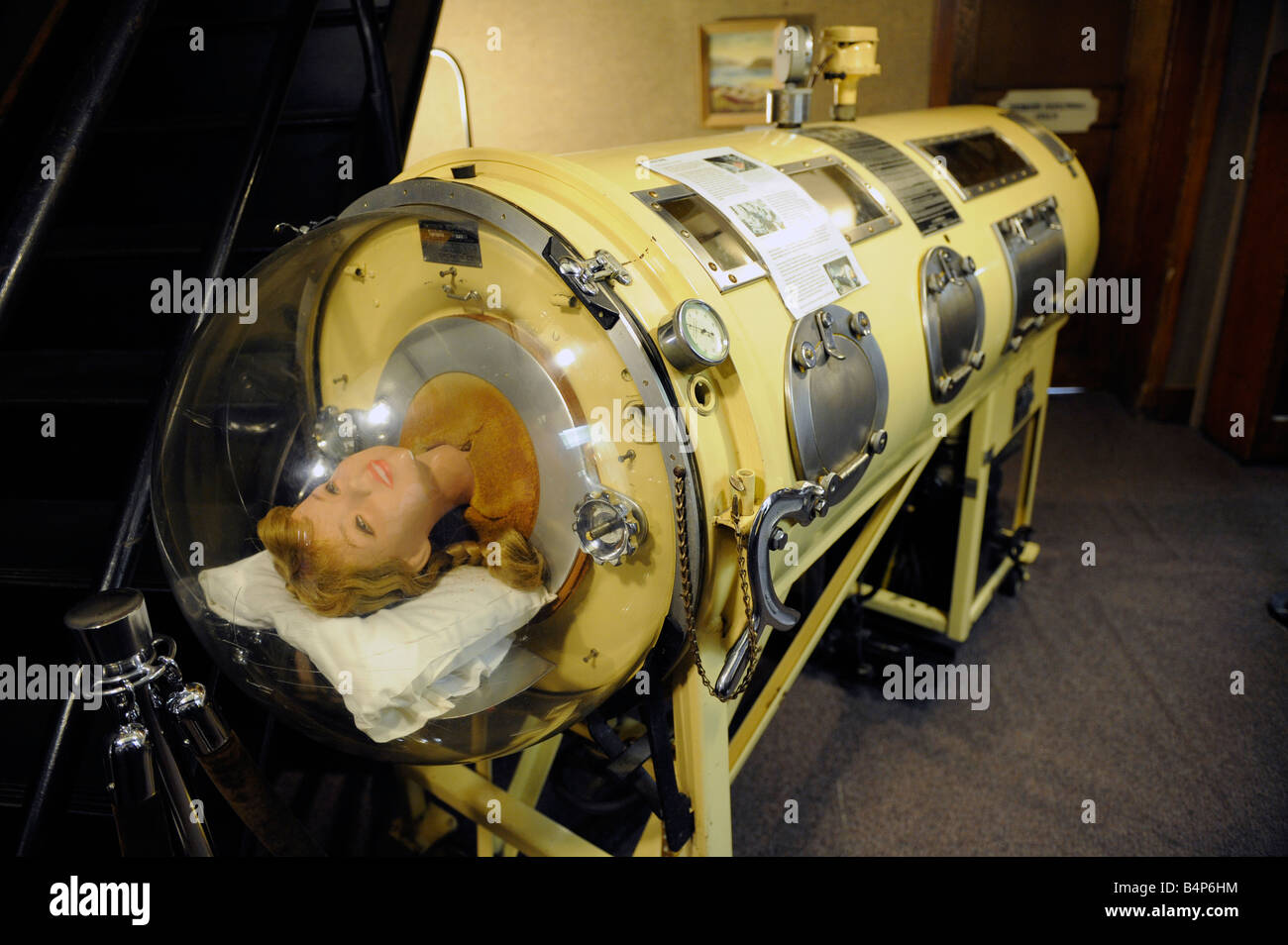 Pulmón de hierro utilizado en 1950 y 1960 para permitir a la persona a