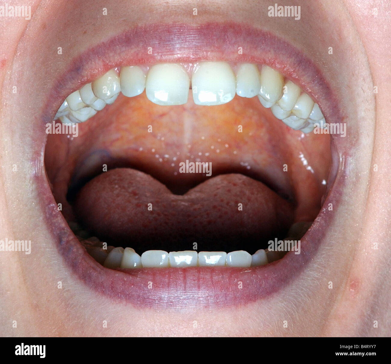 Canto de garganta de dientes en la boca el 9 de septiembre de 2004 Foto de stock