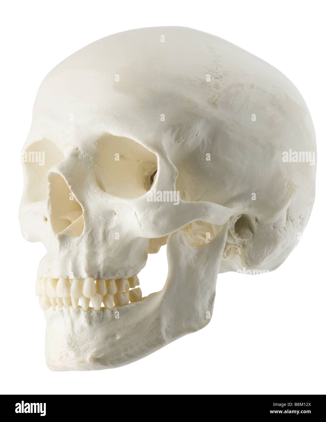 Cráneo,humano,jefe,Vista lateral,dientes,sockets,investigación,,patología forense Foto de stock