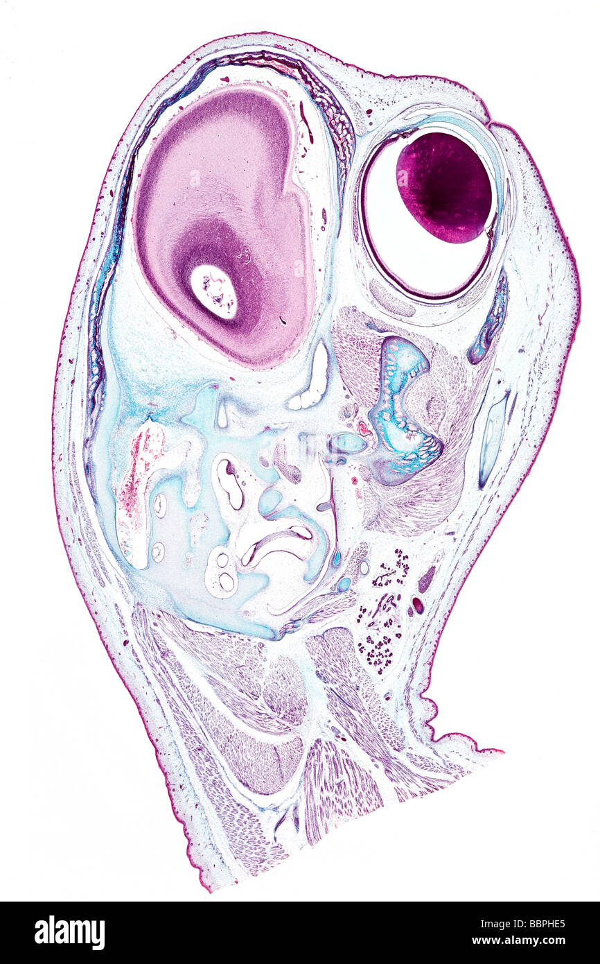 Cat feto, Jefe Sección diapositiva detalle brightfield microfotografía, LS. Foto de stock